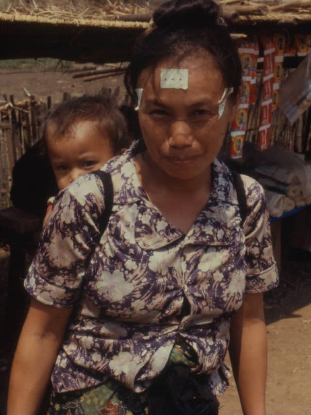 A Hmong mother at Ban Vinai with her young child carried on her back